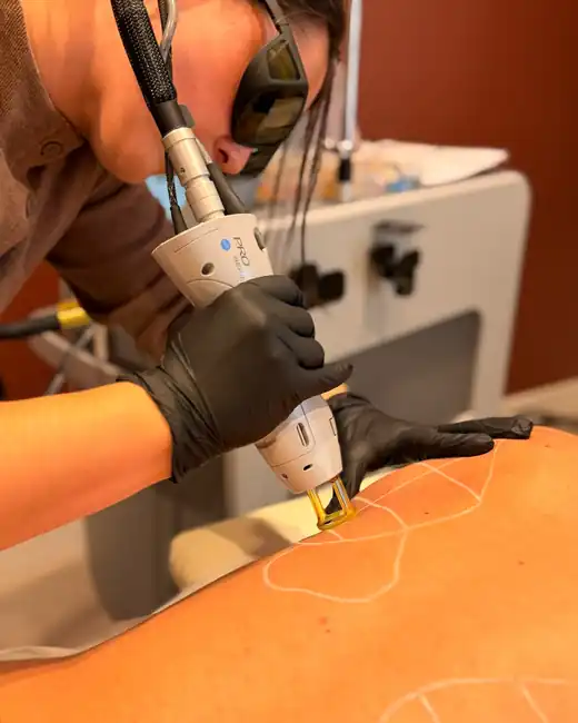 Céline réalisant une séance d’épilation laser